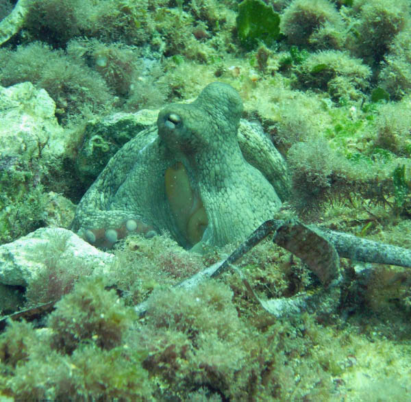 M0010704